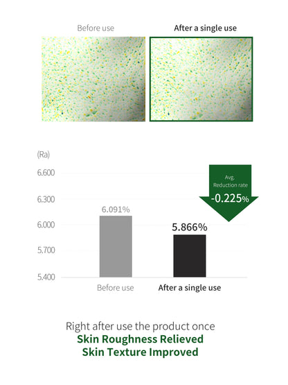 Benton Aloe BHA Skin Toner 200ml - Renewal
