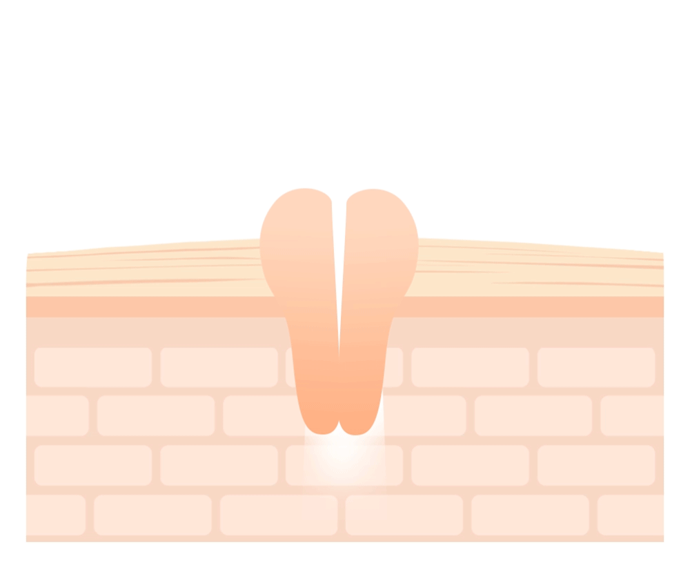 Needly Crossbarrier Mask 30 sheets