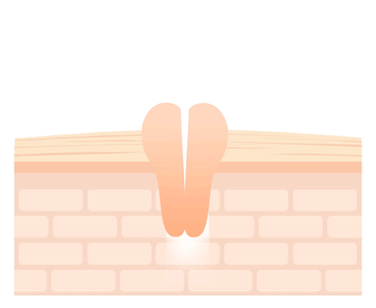 Needly Crossbarrier Mask 30 sheets