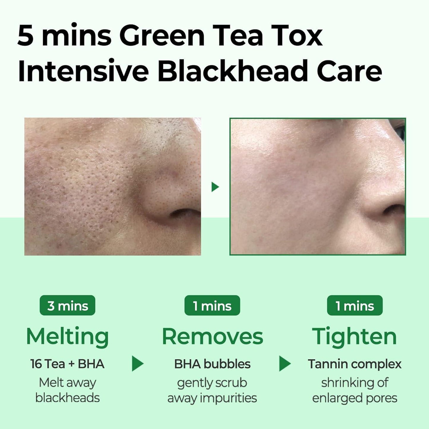 SomeByMi BYE BYE BLACKHEAD 30 DAYS MIRACLE GREEN TEA TOX BUBBLE CLEANSER 120g