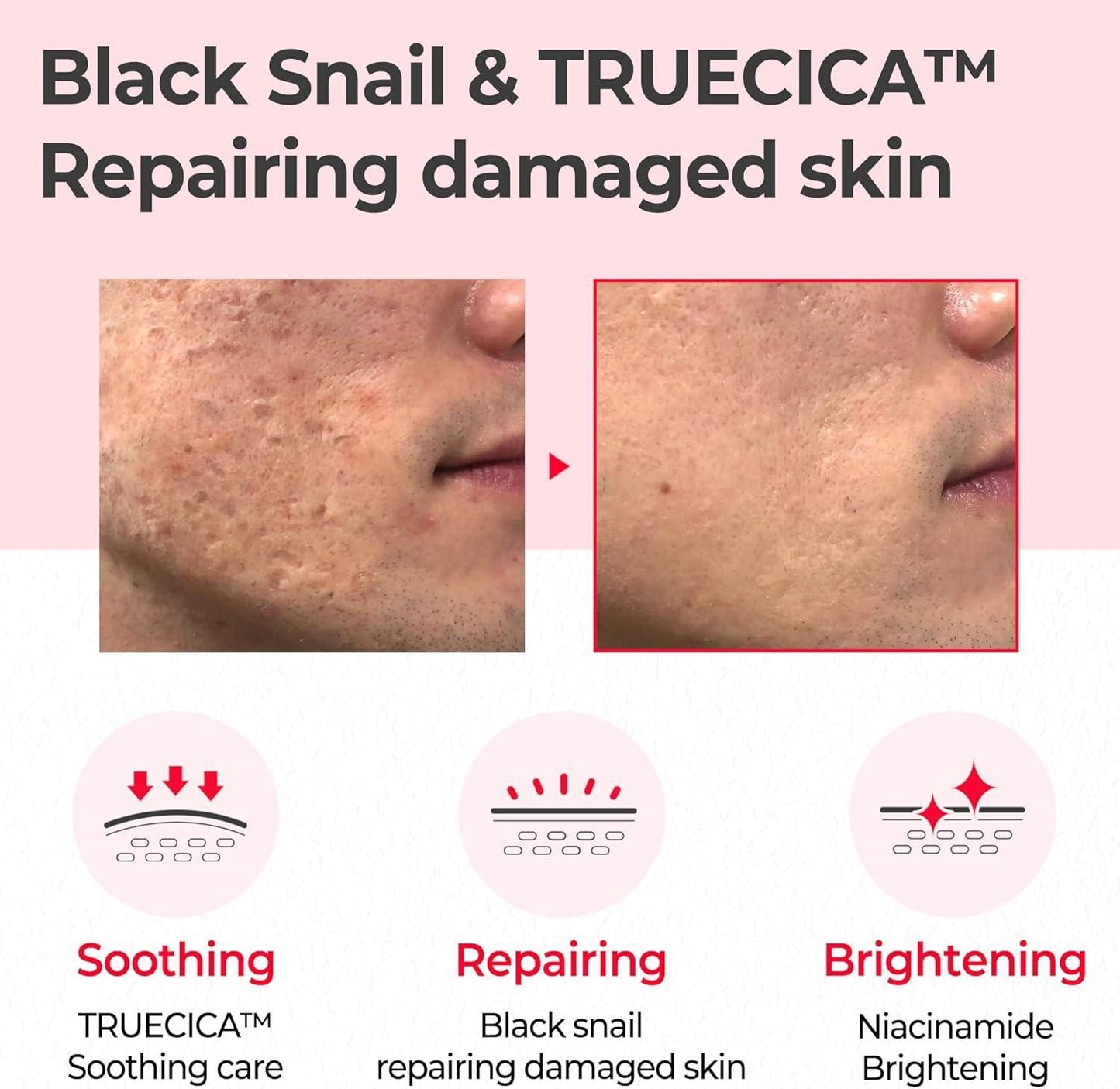 SomeByMi SNAIL TRUECICA MIRACLE REPAIR TONER 150ml