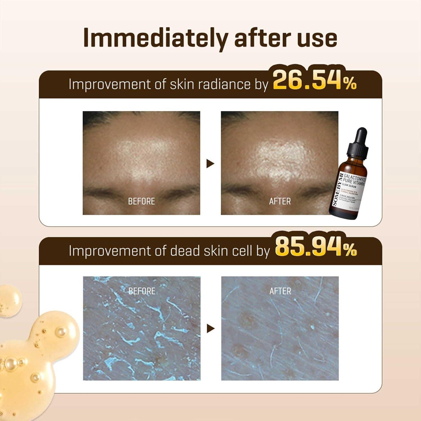 SomeByMi GALACTOMYCES PURE VITAMIN C GLOW SERUM 30ml