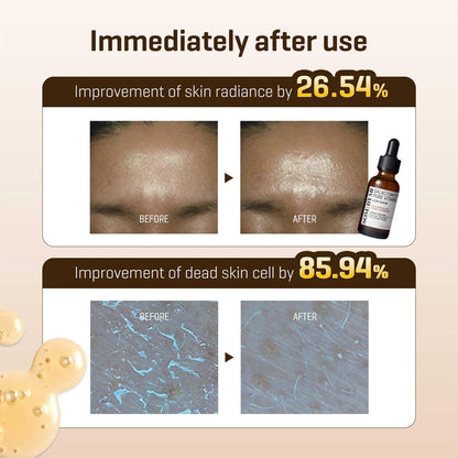 SomeByMi GALACTOMYCES PURE VITAMIN C GLOW SERUM 30ml