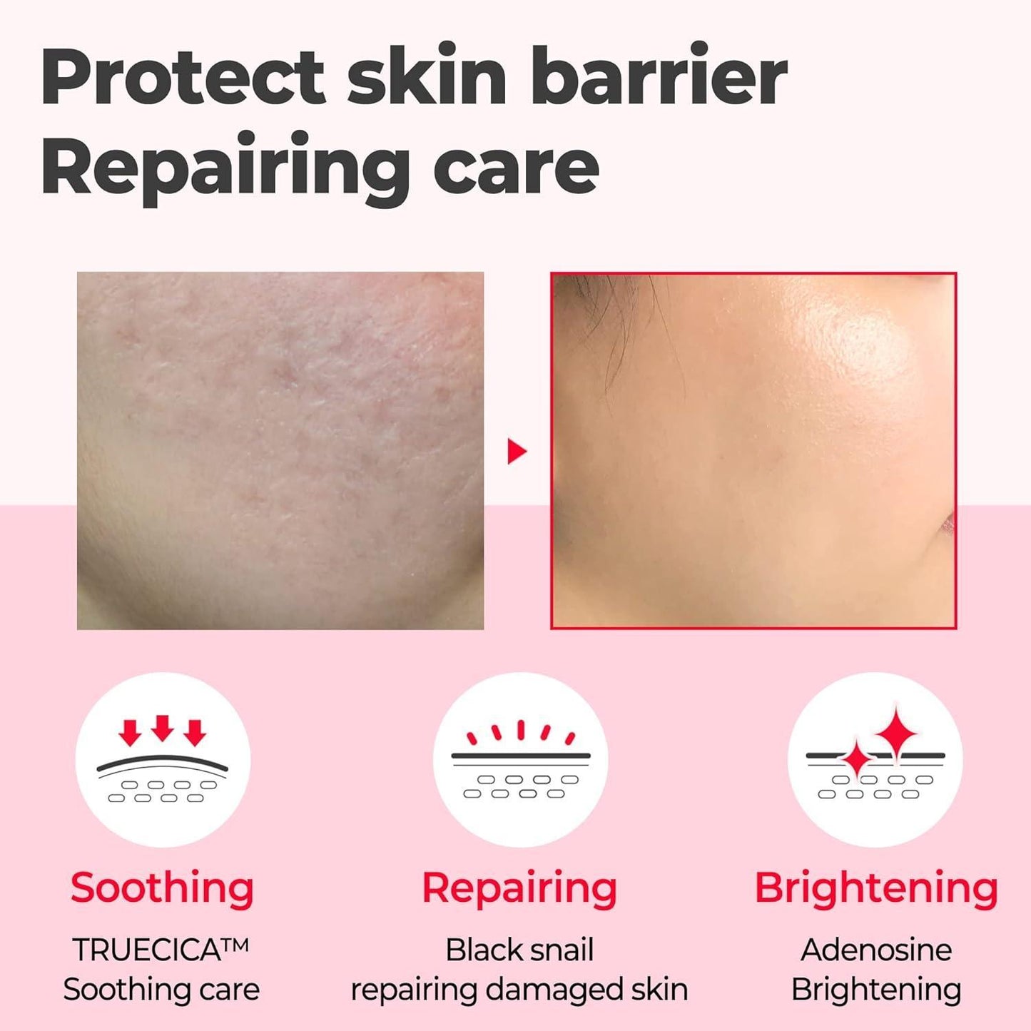SomeByMi SNAIL TRUECICA MIRACLE REPAIR SERUM 50ml