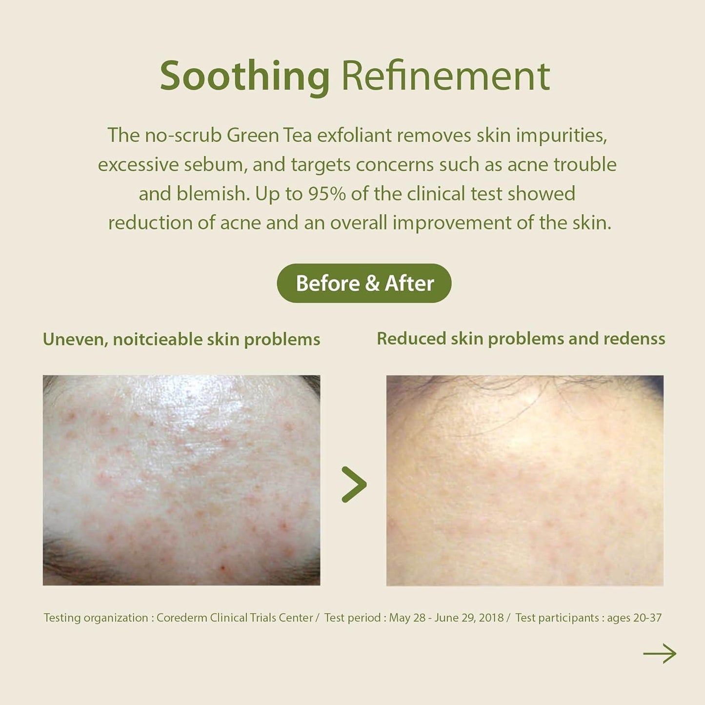 Blithe Patting Splash Mask Soothing & Healing Green Tea 150ml
