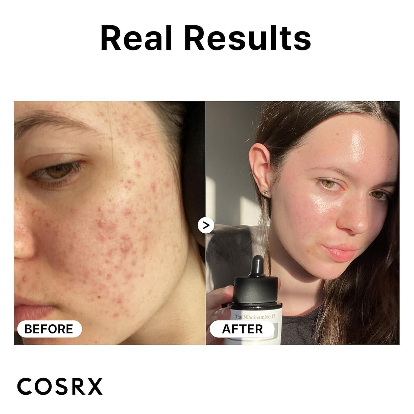 Cosrx The Niacinamide 15 Serum 20ml