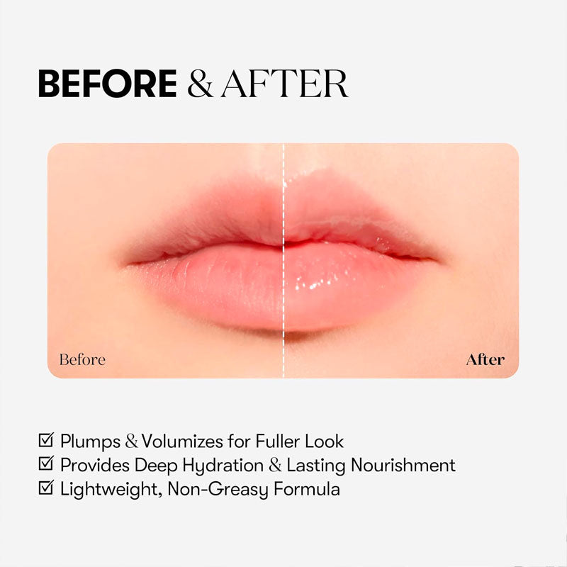 VT Reedle Shot Lip Plumper 4ml - Beginner-3